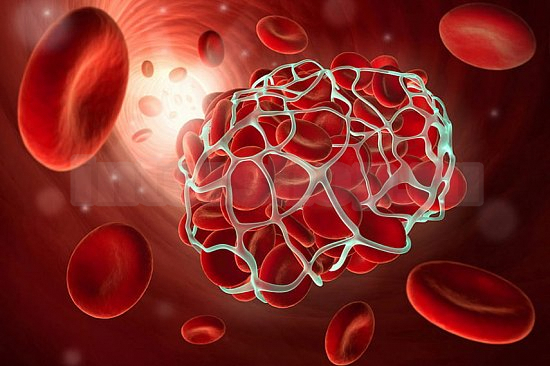 "Беспрецедентное" свертывание крови среди пациентов с COVID-19