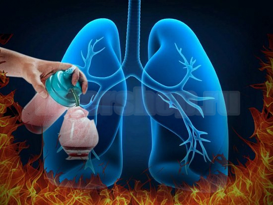 Лечение кислородом: как это происходит?